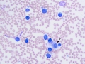 Lymphoma (bovine)