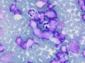 Lymphoma (thymus, cat, DQ)