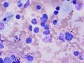 Lymphoma (thymus, cat)