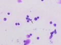 Lymphoma (thymus, cat)