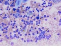 Lymphoma (thymus, cat)