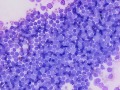 Lymphoma (thymus, cat)