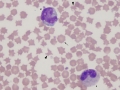 Bovine monocyte & toxic band