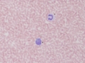 Camelid monocyte & toxic band