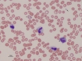 Canine toxic left shift & monocyte