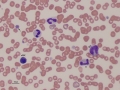 Canine left shift & monocyte