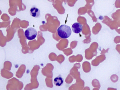 Canine toxic eft shift to myelocyte