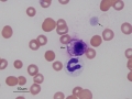 Canine mast cell & toxic band