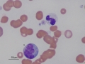 Canine toxic band & monocyte