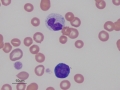 Canine toxic metamyelocyte & reactive lymphocyte