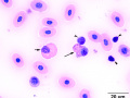 Toxic heterophil & eosinophil (Painted turtle)