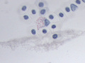 Heterophil (Painted turtle, Luna stain)