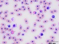 Mixed leukocytes (snapping turtle)