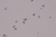 Urine artifacts