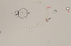 Urine artifacts | eClinpath