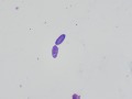 Diatom (Wright's)
