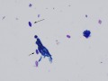 Diatom (Wright's)