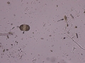 Pollen & fungus