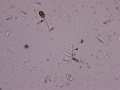 Pollen & fungus