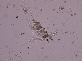 Fungus & bacteria