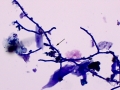 Fungus (Wright's)