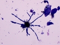 Fungus (Wright's)