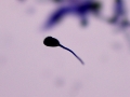 Pollen grain (Wright's)
