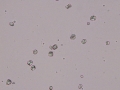 Starch crystals