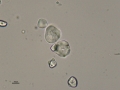 Starch crystals
