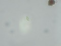 Diatom