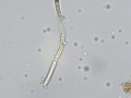 Fungus