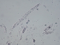 Granular casts