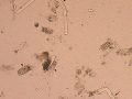 Mixture of casts