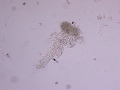 Granular casts