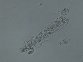 Cellular cast