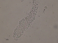 Cellular cast