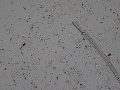 Granular cast