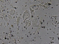 Granular cast