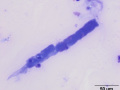Mixed granular and cellular cast (Wright's)