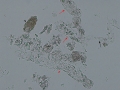 Mixture casts