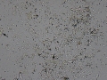 Granular cast
