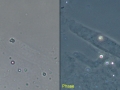 Hyaline compilation