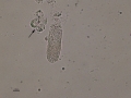 Granular cast