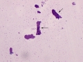 Granular casts (Wright's)