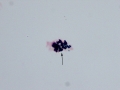 Hemosiderin (Prussian blue)