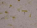 Granular casts