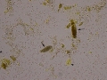 Granular casts