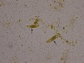 Granular casts