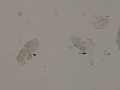 Waxy & granular