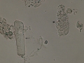 Waxy & granular
